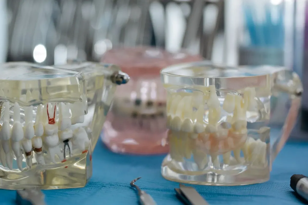 Dental study models showing crowns and a bridge on a work surface