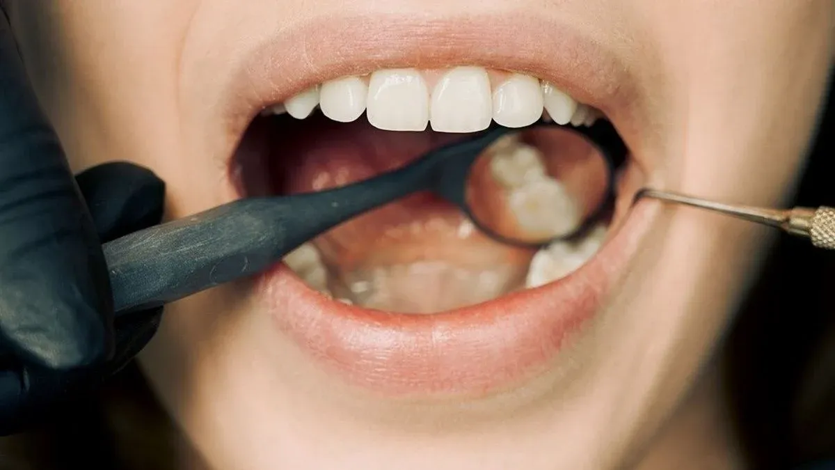 Close-up of an open mouth during a dental exam, with a gloved hand holding a dental mirror and a probe at the teeth