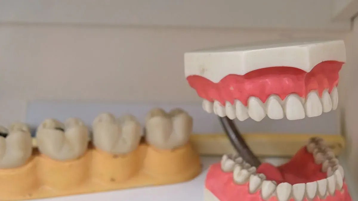 Dental models on a shelf, including a large model of upper and lower teeth and a row of molars