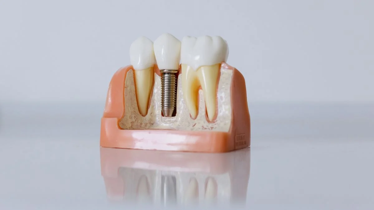 A dental provider examining a patient during an implant-related procedure