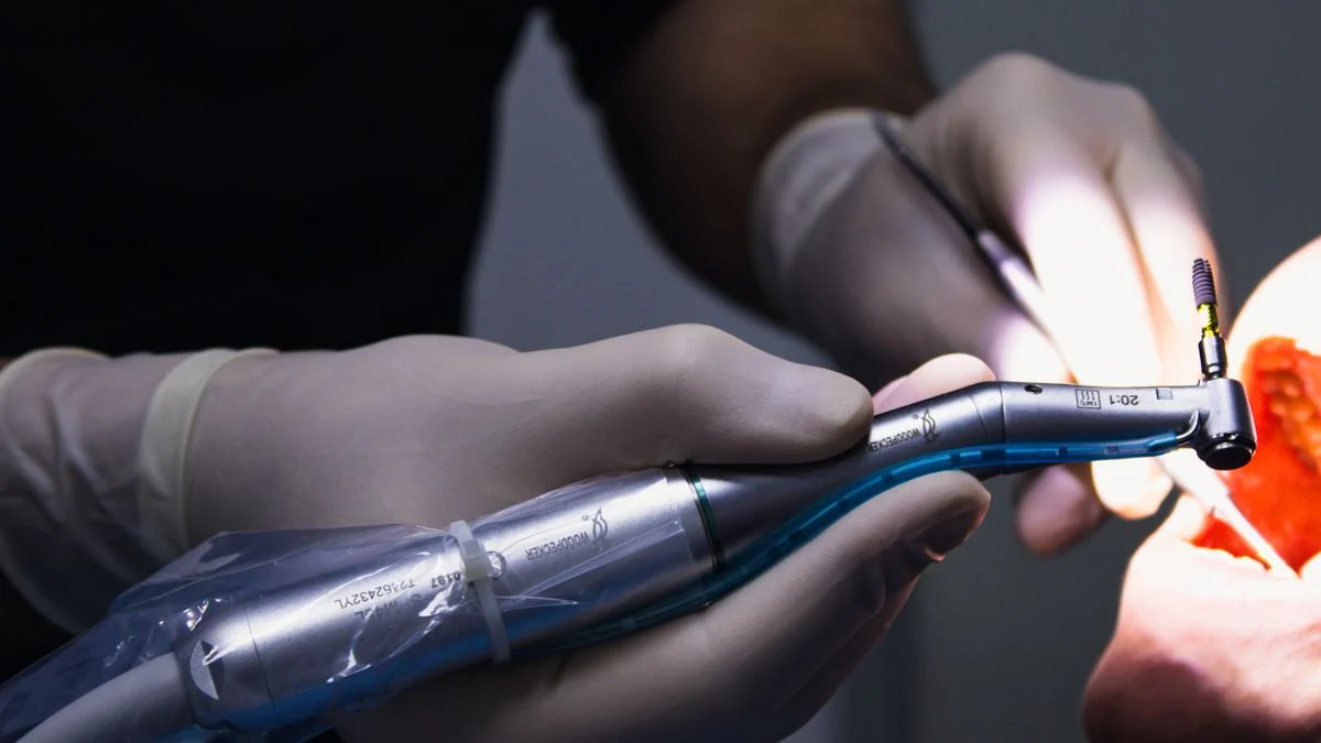 Close-up of a dentist using a drill tool during a filling procedure in a patient mouth