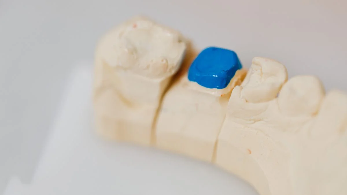 Close-up of a dental jaw model with a filling in place alongside dentistry tools