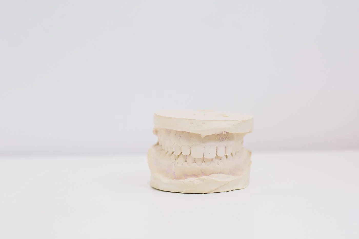 A dental impression model of a set of teeth on a white surface